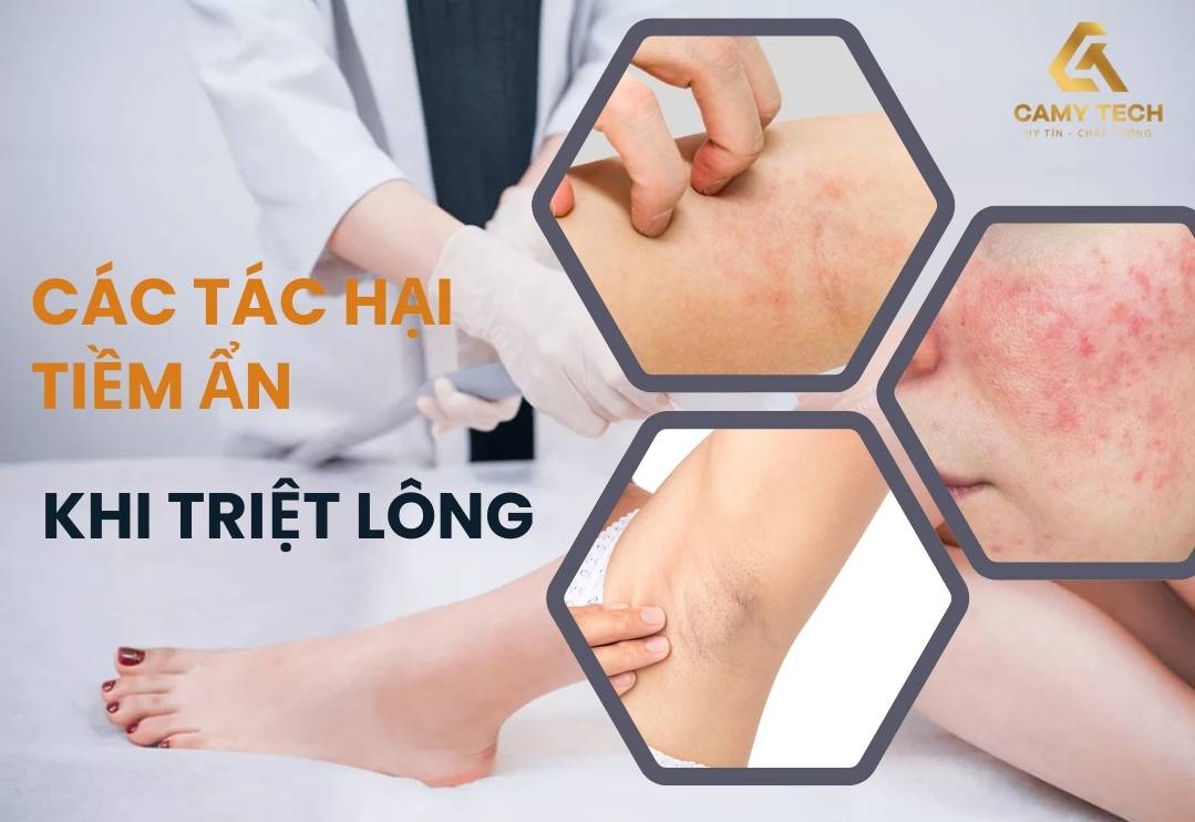 Dùng máy triệt lông có hại không? Có một số tác hại nếu không sử dụng đúng cách