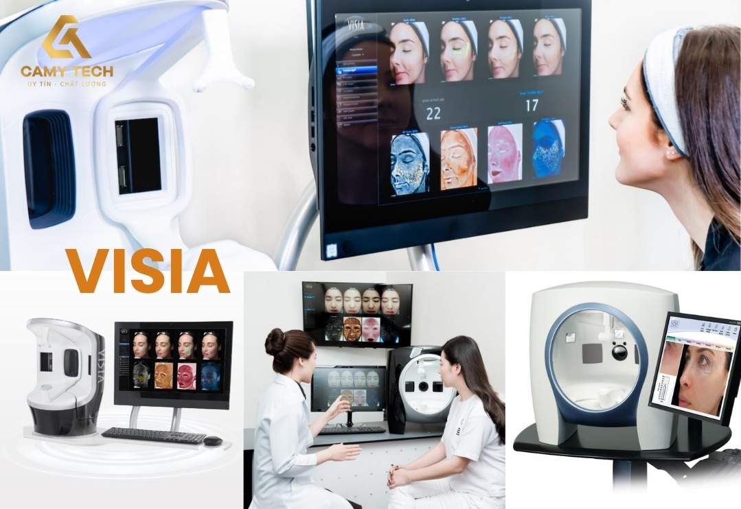 Máy VISIA sử dụng công nghệ tiên tiến nhất trên thị trường