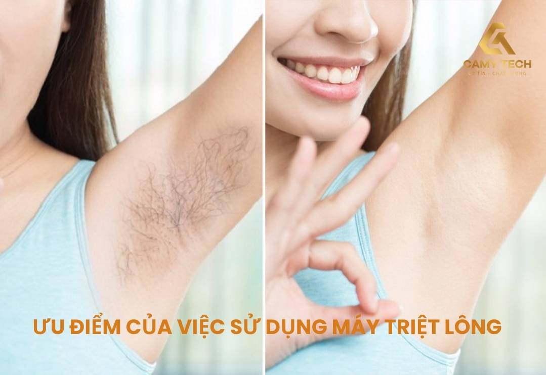 Sử dụng máy triệt lông đem lại nhiều hiệu quả cho người dùng