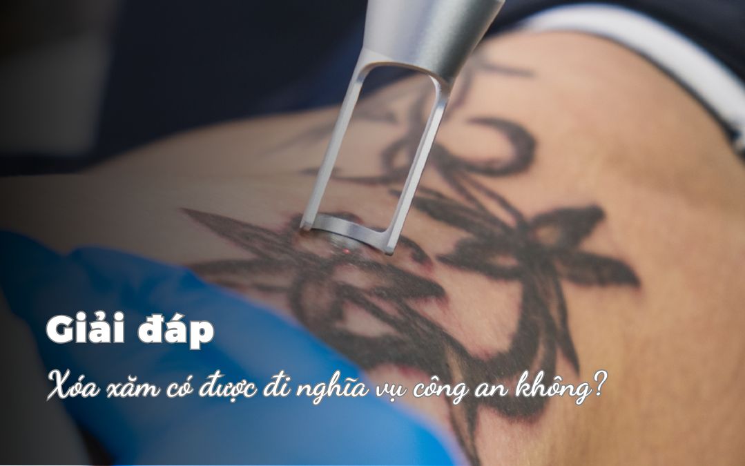 Xóa xăm có được đi nghĩa vụ công an không? Giải đáp