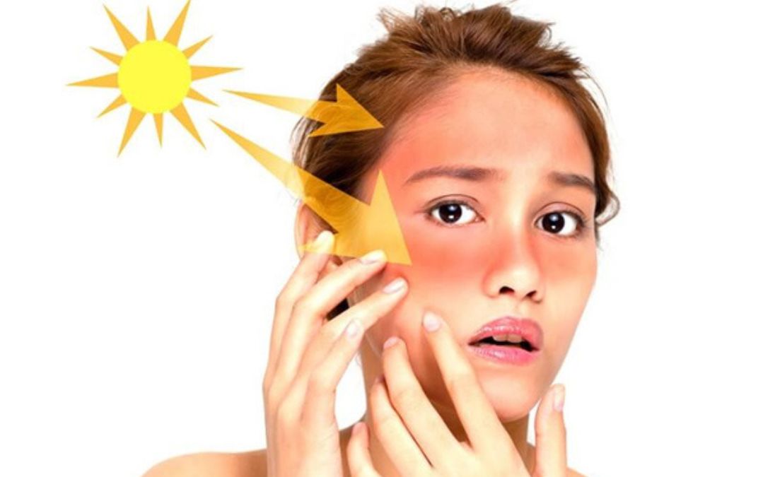 Tia cực tím gây hại đến làn da