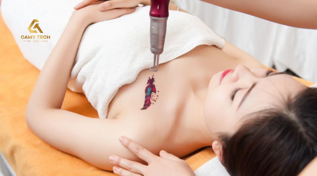 Công nghệ Laser Picosecond ít gây đau đớn, giảm nguy cơ sẹo dù xăm mực màu