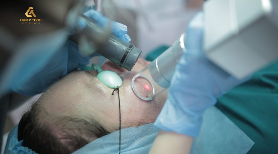 Công nghệ Laser Fractional CO2 giúp điều trị sẹo rỗ lâu năm hiệu quả