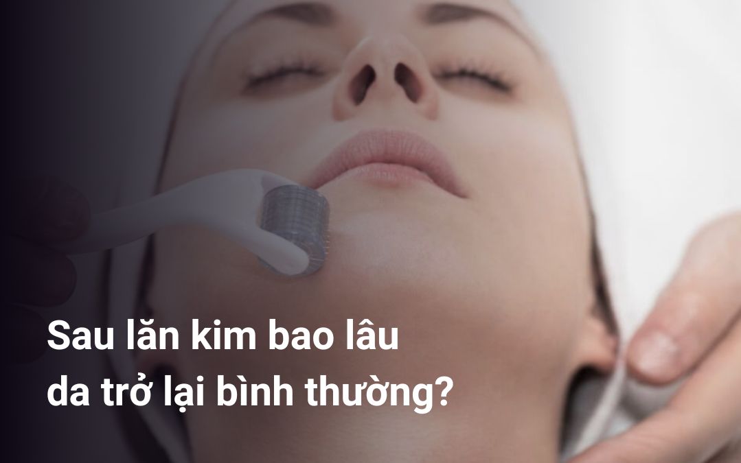 Sau lăn kim bao lâu da trở lại bình thường? Giải đáp