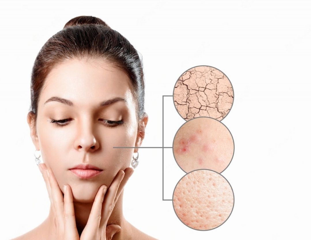 Soi da để phát hiện sớm các vấn đề về da