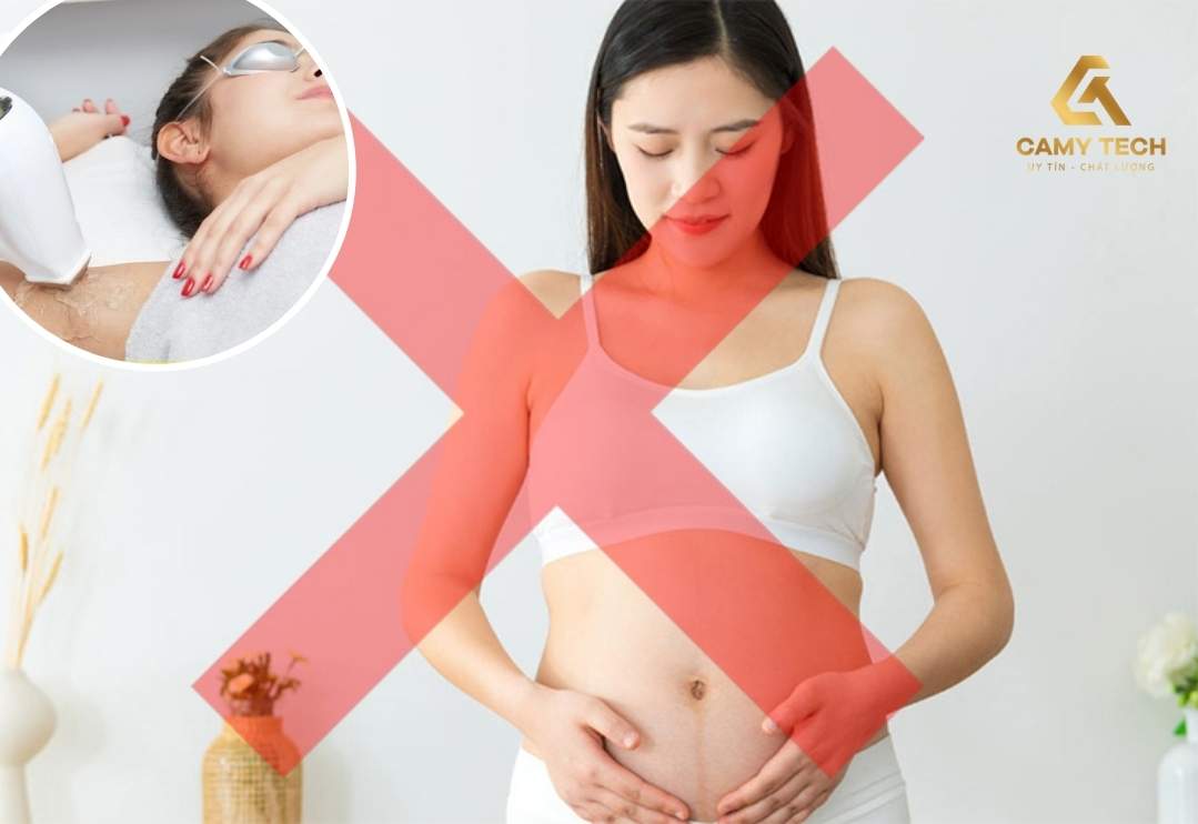 Mẹ bầu không nên triệt lông laser trong quá trình mang thai