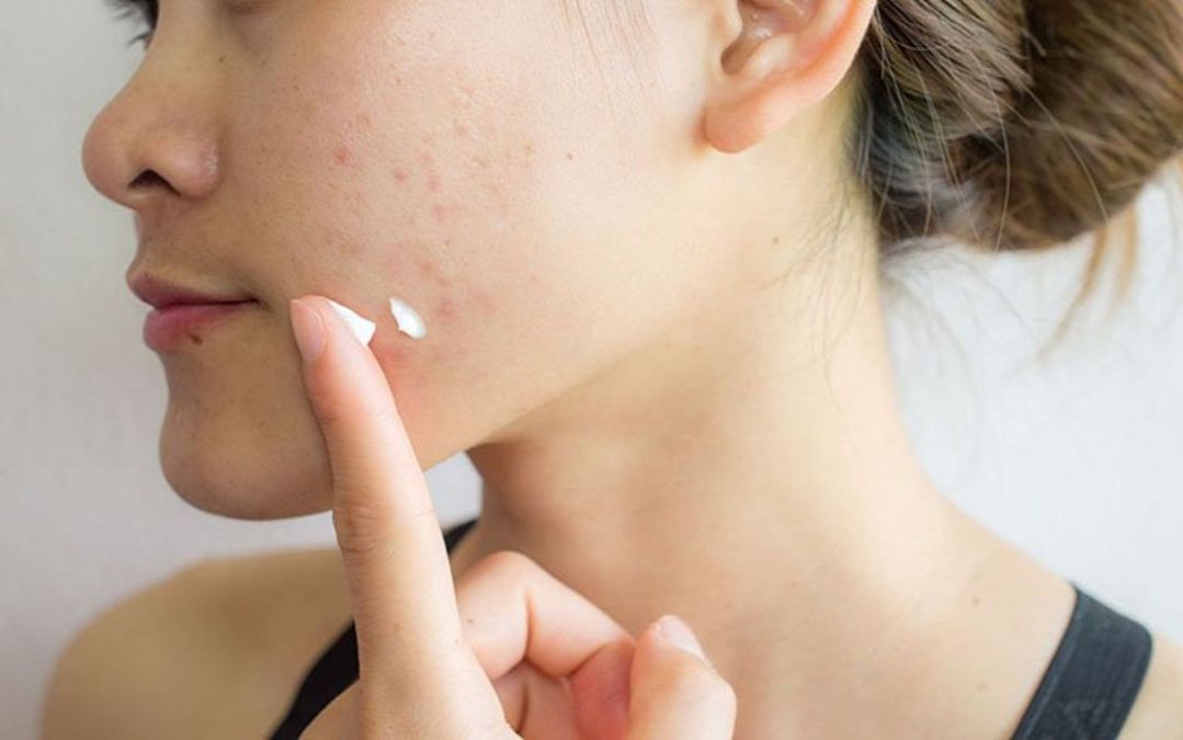 Thoa kem chống nắng trước khi ra ngoài để bảo vệ da