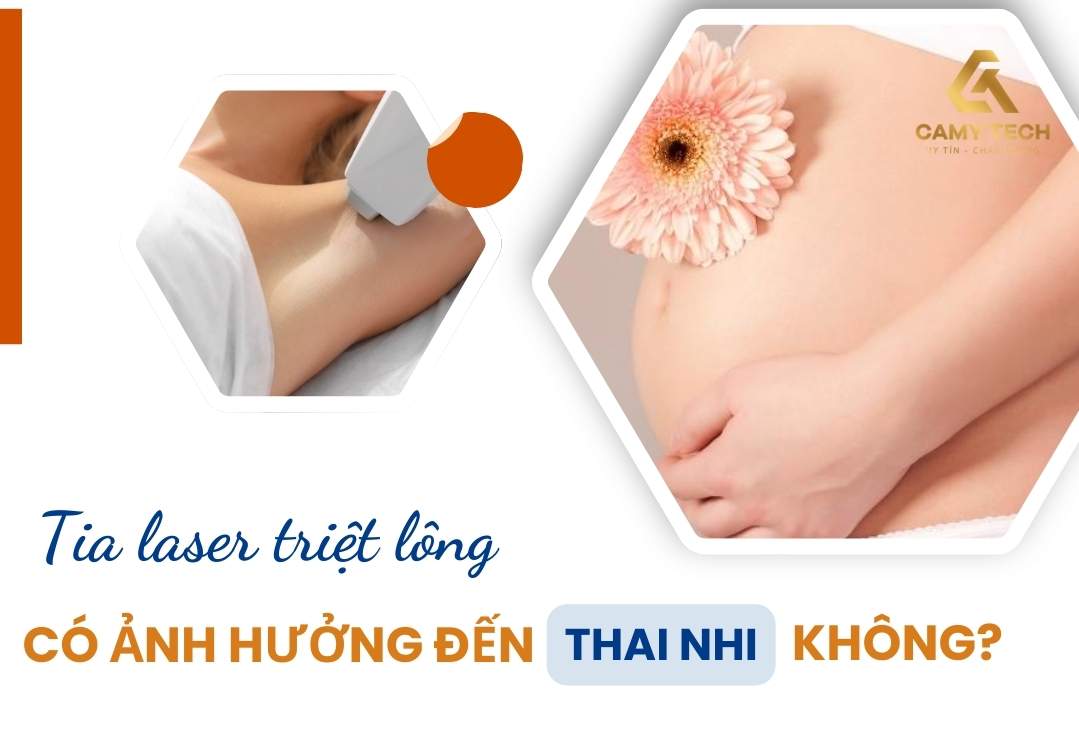 Tia laser triệt lông không gây hại trực tiếp cho thai nhi
