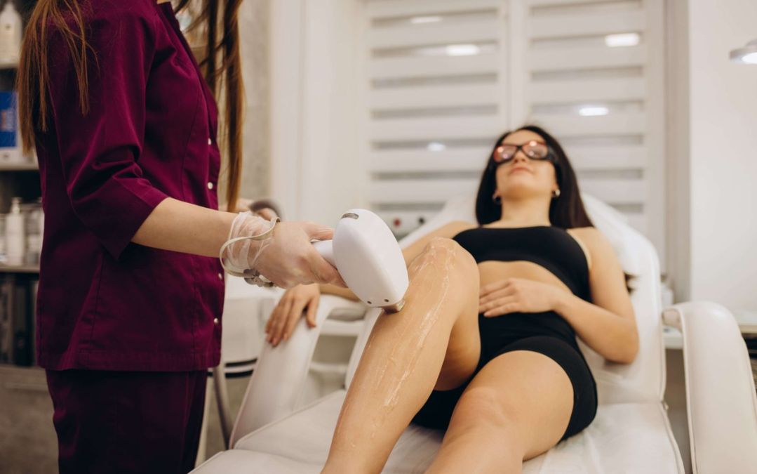 Triệt lông lạnh không đau bằng triệt lông nóng