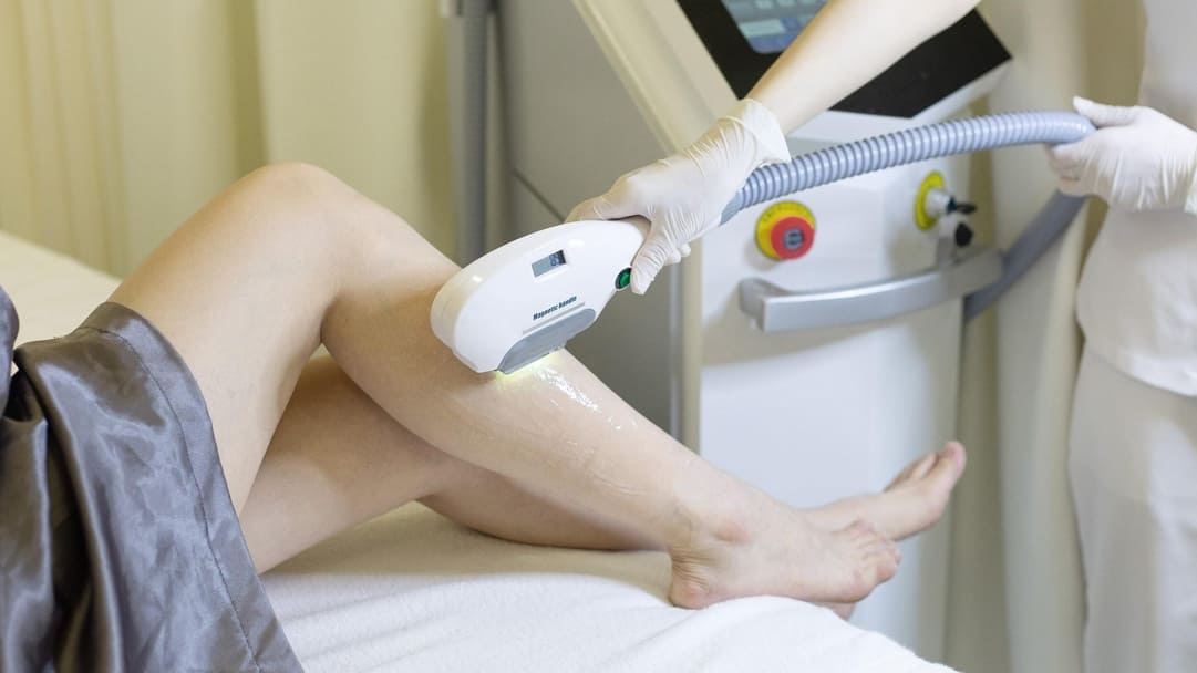Căn cứ vào thời gian, liệu trình để đánh giá triệt lông lạnh hay nóng tốt hơn