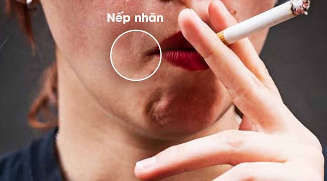 Hút thuốc có ảnh hưởng đến da mặt không, tác động như thế nào?
