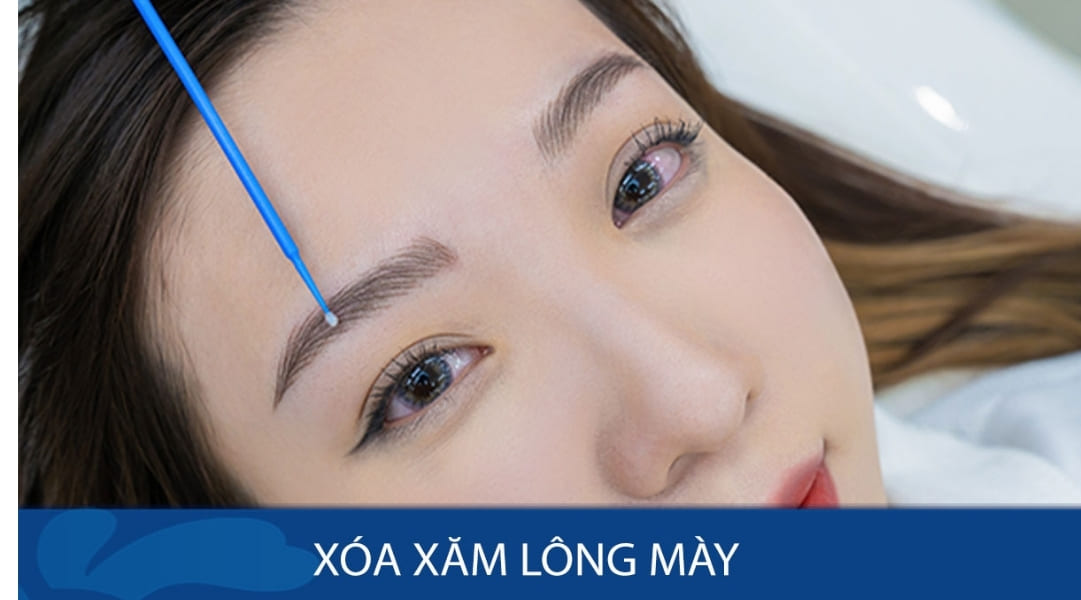 Kangnam cam kết xóa sạch mực xăm mà không để lại màu chì