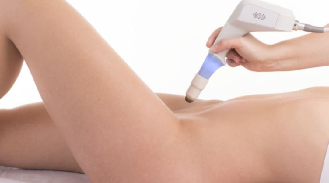Review làm hồng vùng kín bằng laser với quy trình đơn giản