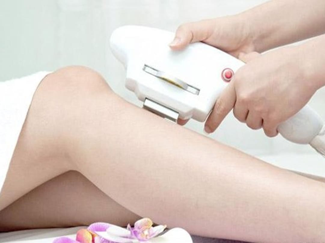 triệt lông lạnh hay nóng tốt hơn