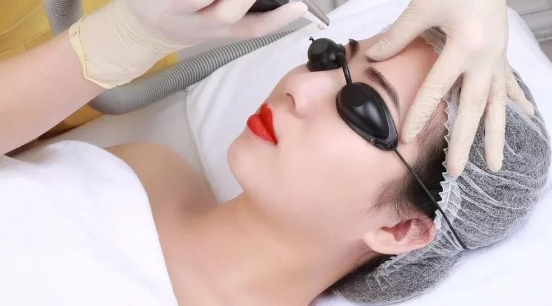 Xóa xăm chân mày uy tín tại bệnh viện thẩm mỹ Việt Mỹ