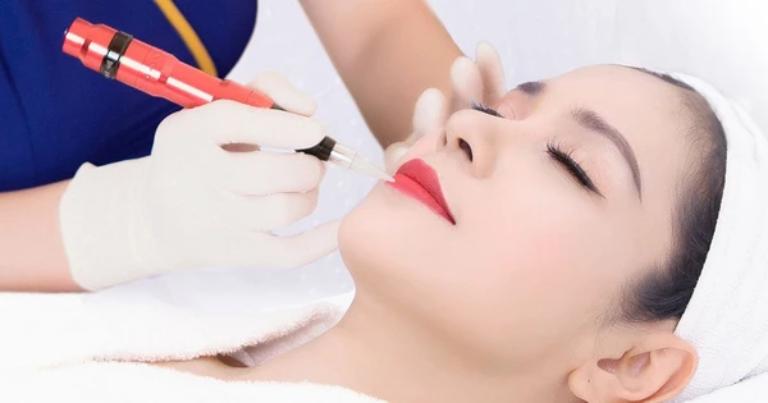 Giải đáp xăm môi xong có xóa được không